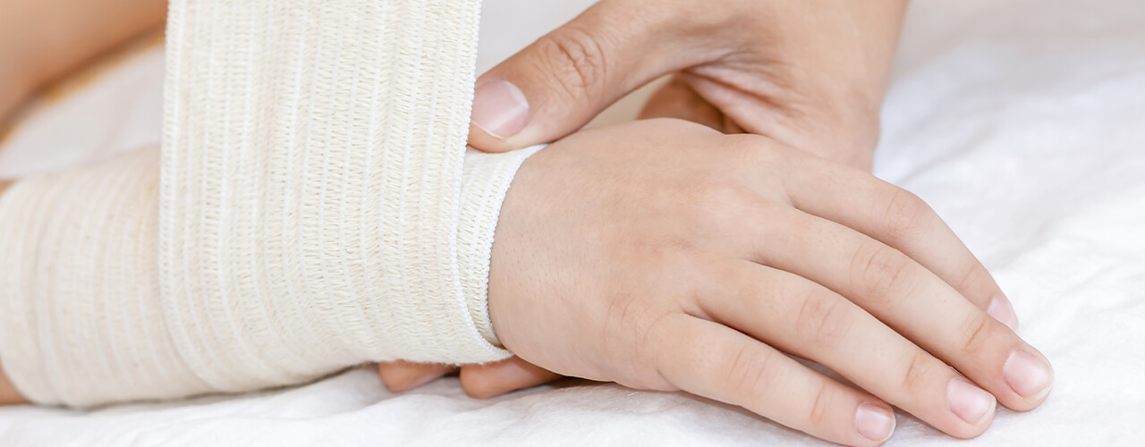 Stress Fractures Southwest Florida